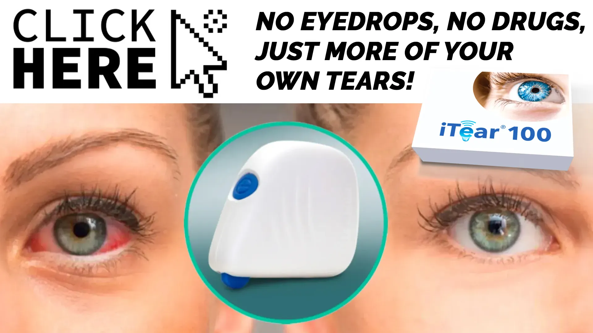 Introducing the iTEAR100 Device for Dry Eye Relief