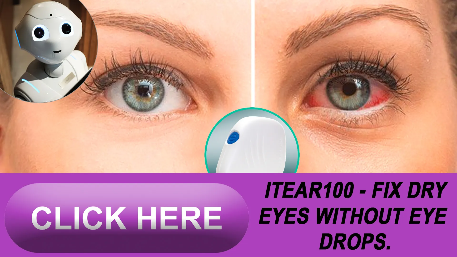 3. Spotting and Addressing Dry Eye Symptoms