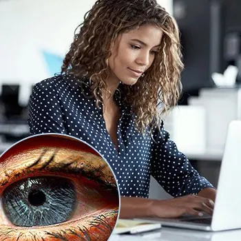 Understanding Dry Eye Syndrome and Work-related Eye Stress